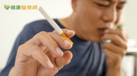65歲男久咳未痊以為感冒　一檢竟是「肺癌」上身