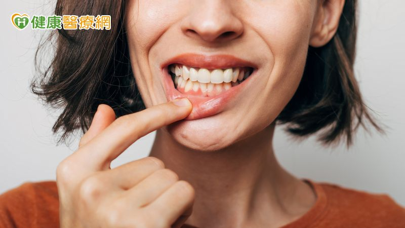 缺牙要植牙還是裝假牙？適用族群有哪些？醫：年輕患者應盡量保留「自然牙」