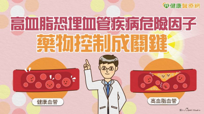 高血脂恐埋血管疾病危險因子　藥物控制成關鍵
