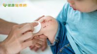 小擦傷想自己消毒殺菌　優碘、碘酒卻分不清？ 用錯可能延緩傷口復原！