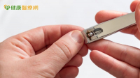 剪指甲太深惹禍　年輕女急性甲溝炎痛到跛行