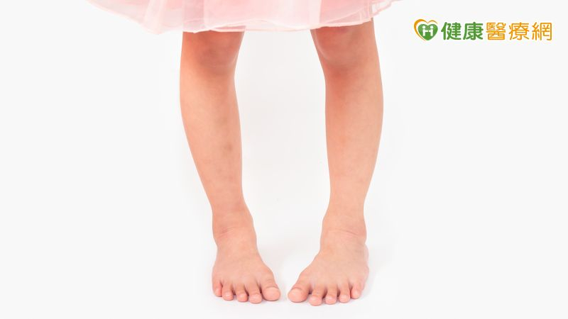 如果發現孩子內八角度明顯，常常跌倒、影響運動表現，或是合併有膝蓋、髖關節的疼痛，家長就要帶孩子到小兒骨科或復健科評估。