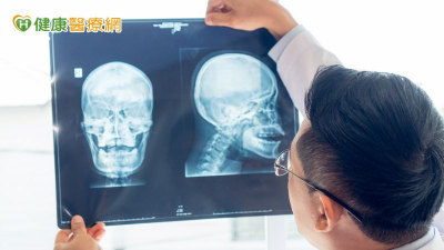 頭頸癌病人手術後還能保有自然外觀　客製化口腔顱顏技術受關注