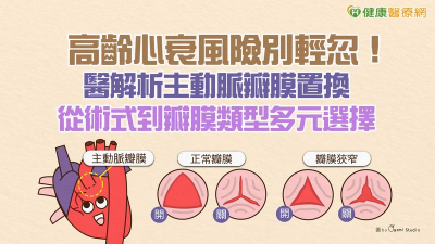 高齡心衰風險別輕忽！醫解析主動脈瓣膜置換　從術式到瓣膜類型多元選擇