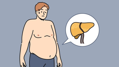 糖尿病、肥胖要注意！脂肪肝嚴重恐致肝癌...醫教「預防關鍵」連代謝症候群都改善
