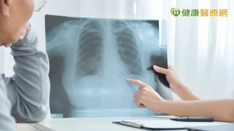 肺癌標靶出現抗藥性！破解迷思才能看見治療新方向