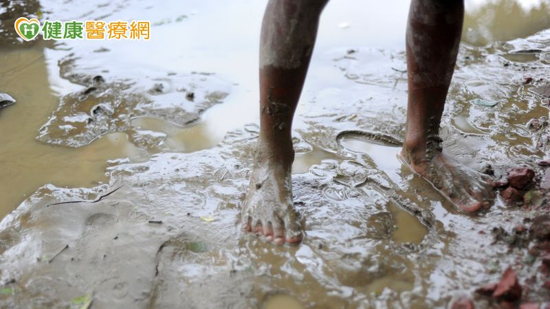 類鼻疽的臨床表現多變，輕則局部蜂窩性組織炎、出現紅腫熱痛症狀，重則演變成肺炎、菌血症、甚至敗血性休克。