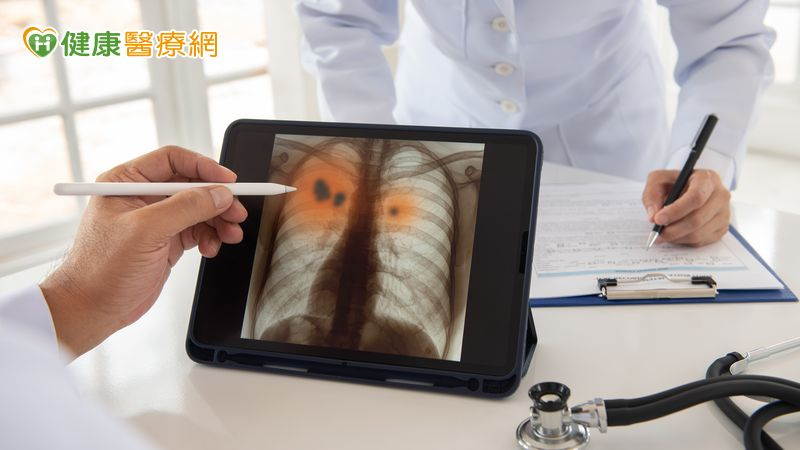 近年來,免疫藥物治療在小細胞肺癌領域開始展現希望。
