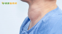 失控的甲狀腺亢進可能引發甲狀腺風暴！醫師教你如何控制甲狀腺
