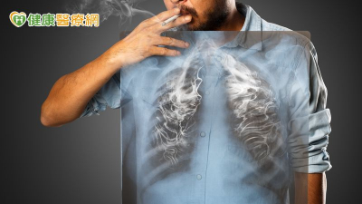 肺阻塞傷肺也傷心！教你「5大抗惡行動」保肺護心、防惡化