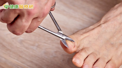 八旬翁厚甲致嵌甲多年　醫院「專業足部護理」解決疼痛之苦