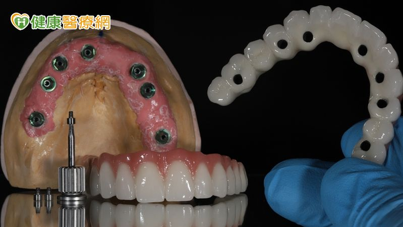 隨著數位牙科技術成熟，All-on-4全口重建已從仰賴傳統經驗的治療方式，進化為結合數位規劃、快速復原的智慧新選擇。