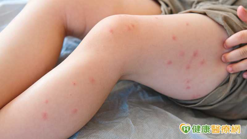蘋果病在台灣稱為傳染性紅斑，專家對此提醒，高危險群包括血液疾病者、免疫功能低下者與孕婦。