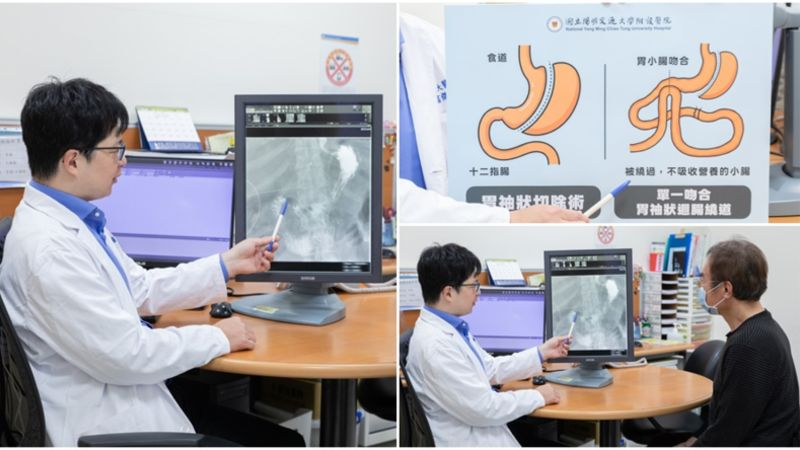 陽明交大醫院外科莊富傑醫師為超胖男施以「腹腔鏡胃袖狀切除合併腸繞道手術」成功減去一半的體重。（圖∕陽明交大醫院）