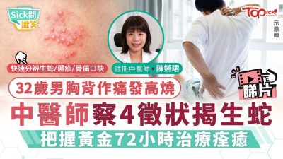 32歲男胸背作痛發高燒　中醫師察4徵狀揭生蛇 把握黃金72小時治療痊癒
