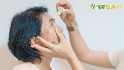 青光眼患者必看！食藥署：1族群眼藥水別點錯　長期用「這類藥」留意眼壓