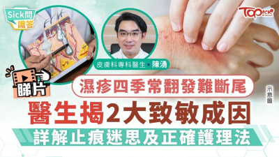 濕疹四季常翻發難斷尾　醫生詳解2大致敏成因及止痕迷思
