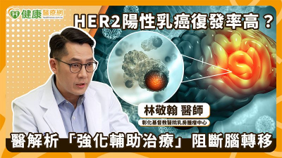 HER2陽性乳癌易腦轉移　高風險群可依情況進行「多一年治療防線」