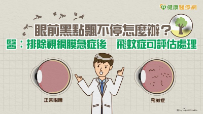 眼前黑點飄不停怎麼辦？醫：排除視網膜急症後　飛蚊症可評估處理