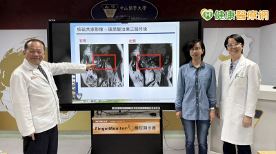 總不自覺咬牙也釀頭痛、肩頸痛？醫：當心「顳顎關節障礙症候群」上身