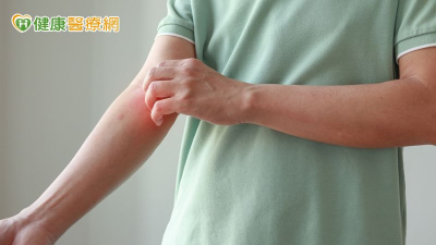 過敏族注意！醫揭「異病同治」新觀念　治療方式大改變