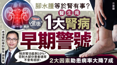 腳水腫等於腎有事？　醫生揭1大腎病早期警號　2大因素助患病率大降7成