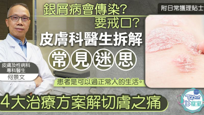 銀屑病會傳染？患者要戒口？醫生解構常見迷思及4大治療方法