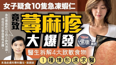 女子疑食10隻急凍蝦仁竟致蕁麻疹大爆發　醫生拆解4大致敏食物：1種情形速求醫