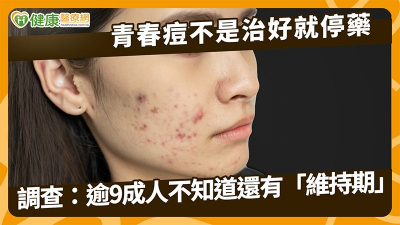 青春痘不是治好就停藥　調查：逾9成人不知道還有「維持期」
