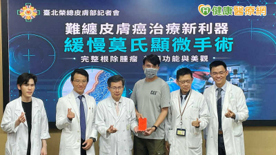 皮膚癌長在眼鼻口、腳底要當心　北榮「緩慢莫氏手術」拚留健康組織