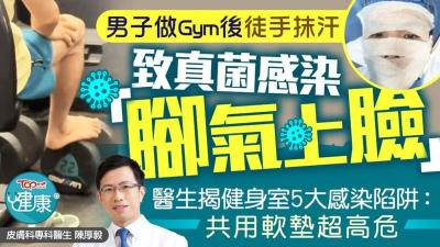 男子做Gym後徒手抹汗致真菌感染「腳氣上臉」　醫生揭健身室5大感染陷阱：共用軟墊超高危