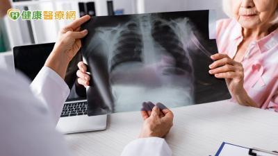 破解肺癌偽裝身份！靠免疫四藥聯合有望取得長期存活效益