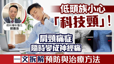 低頭族小心「科技頸」！肩頸痛症隨時變成神經痛 一文拆解預防與治療方法