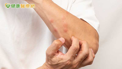 換季皮膚乾癢怎麼辦？醫揭常見原因　保濕、洗澡習慣是關鍵