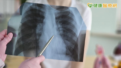 晚期EGFR突變型肺癌治療怎麼選？醫：大型臨床證據、治療指引是重要參考