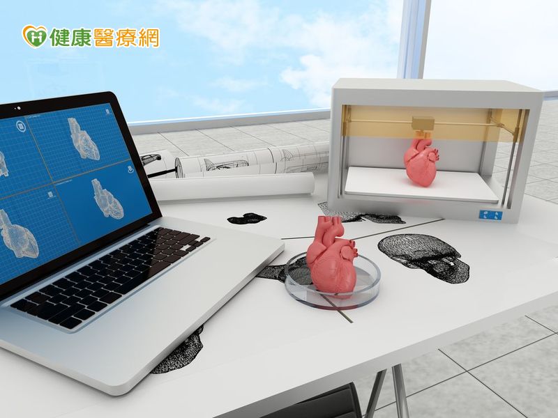 3D列印技術　降低心瓣膜手術風險
