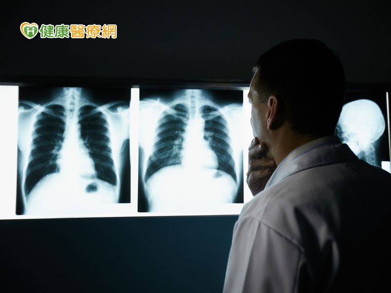 腰痠背痛好不了? 恐是肺癌骨轉移作怪