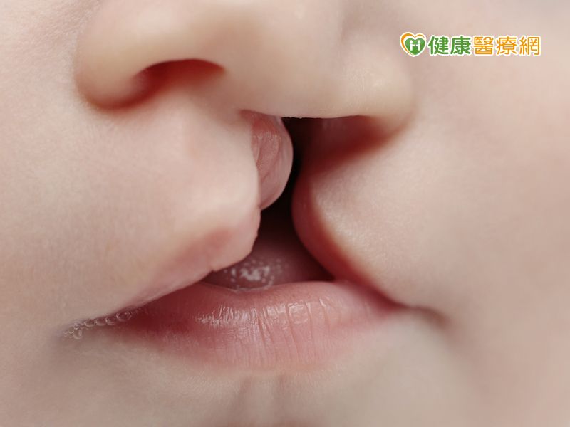 我們都一樣 她 擺脫唇顎裂歧視 健康醫療網 健康養生新聞資訊網路媒體