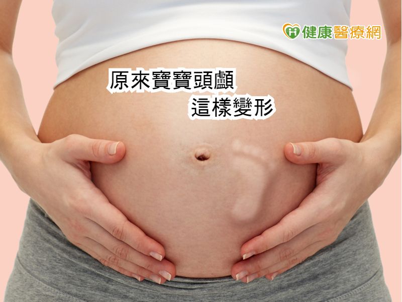 寶寶頭顱好軟q 通過媽媽產道情形曝光 健康醫療網 健康養生新聞資訊網路媒體