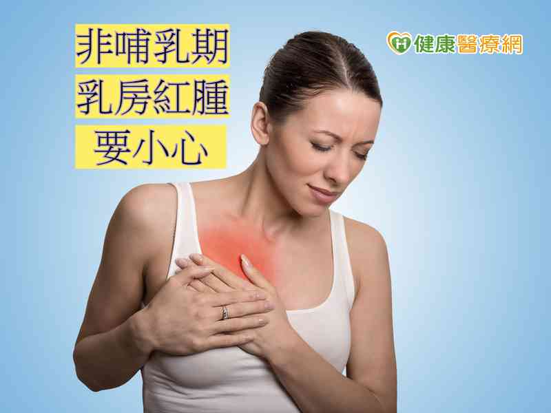 膿瘍 乳腺