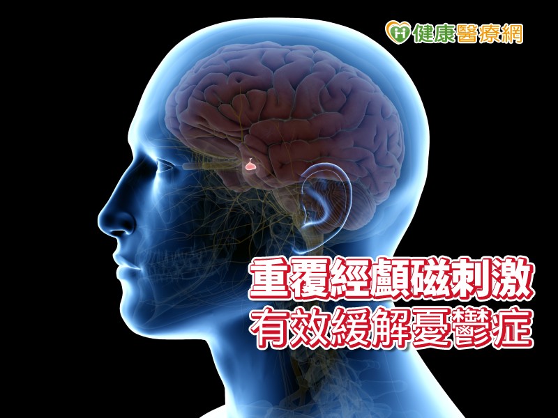 重複經顱磁刺激　免吃藥擺脫憂鬱症_圖1