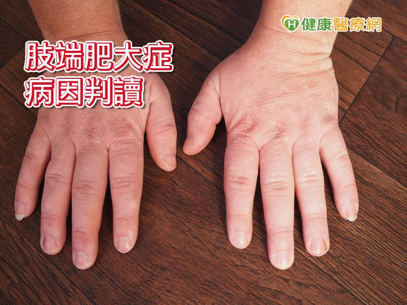 外型變大如史瑞克肇因 這個 出錯啦 健康醫療網 健康養生新聞資訊網路媒體