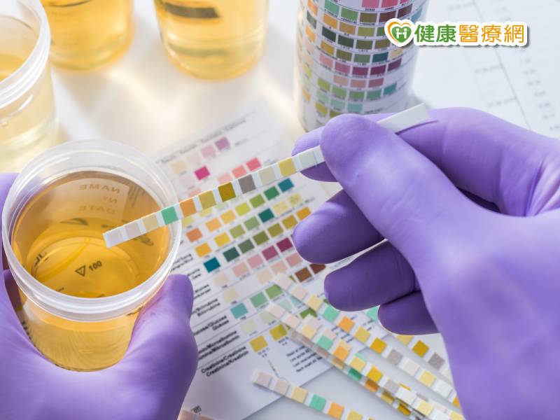 常規的尿液檢查 到底能找出那些毛病? - 健康醫療網 - 健康養生新聞資訊網路媒體