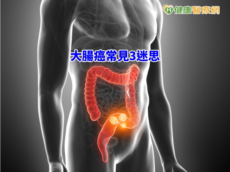 大腸癌常見3迷思　專科醫師一次說清楚_圖1