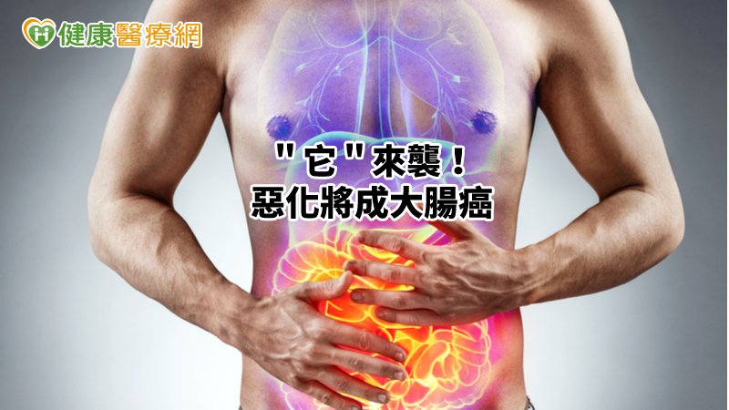 ＂大腸激躁症＂來襲！惡化將成大腸癌