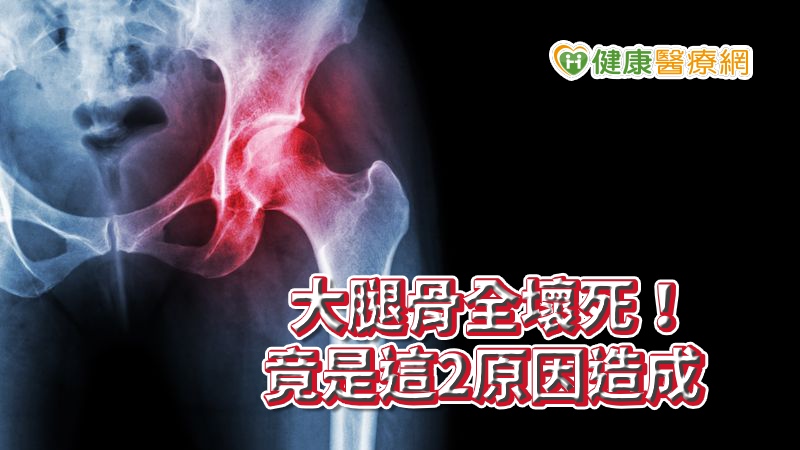 愛喝酒再加上過度運動,當心久了阻塞大腿骨的微細血管,導致身體骨頭壞死!童綜合醫院收治一名定居在台工作的德國男子,13年前漠視大腿骨疼痛,最後演變成關節炎,必須以手術來置換人工關節。