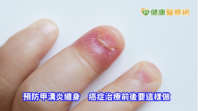癌症治療發展越來越多元化，很多患者會使用副作用較低的標靶治療，但會使神經末端的（Substance-P）物質P產生增加，抑制皮膚代謝，導致出現皮膚乾燥、皮膚紅疹、甲溝炎，嚴重影響到生活品質。