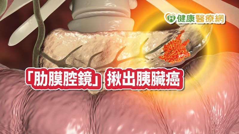 臉凹人消風！　咳喘、爆瘦竟是「癌王」上身