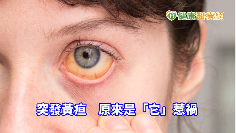 七旬婦人突發黃疸　原來是「它」惹禍