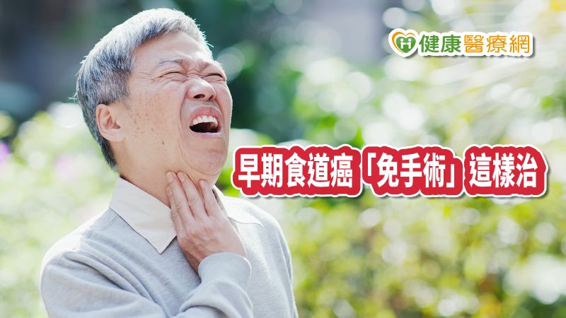燙死癌細胞？　早期食道癌「免手術」這樣治